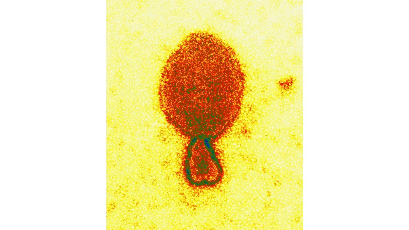 CSIRO ScienceImage 1718 The Hendra Virus by CSIRO