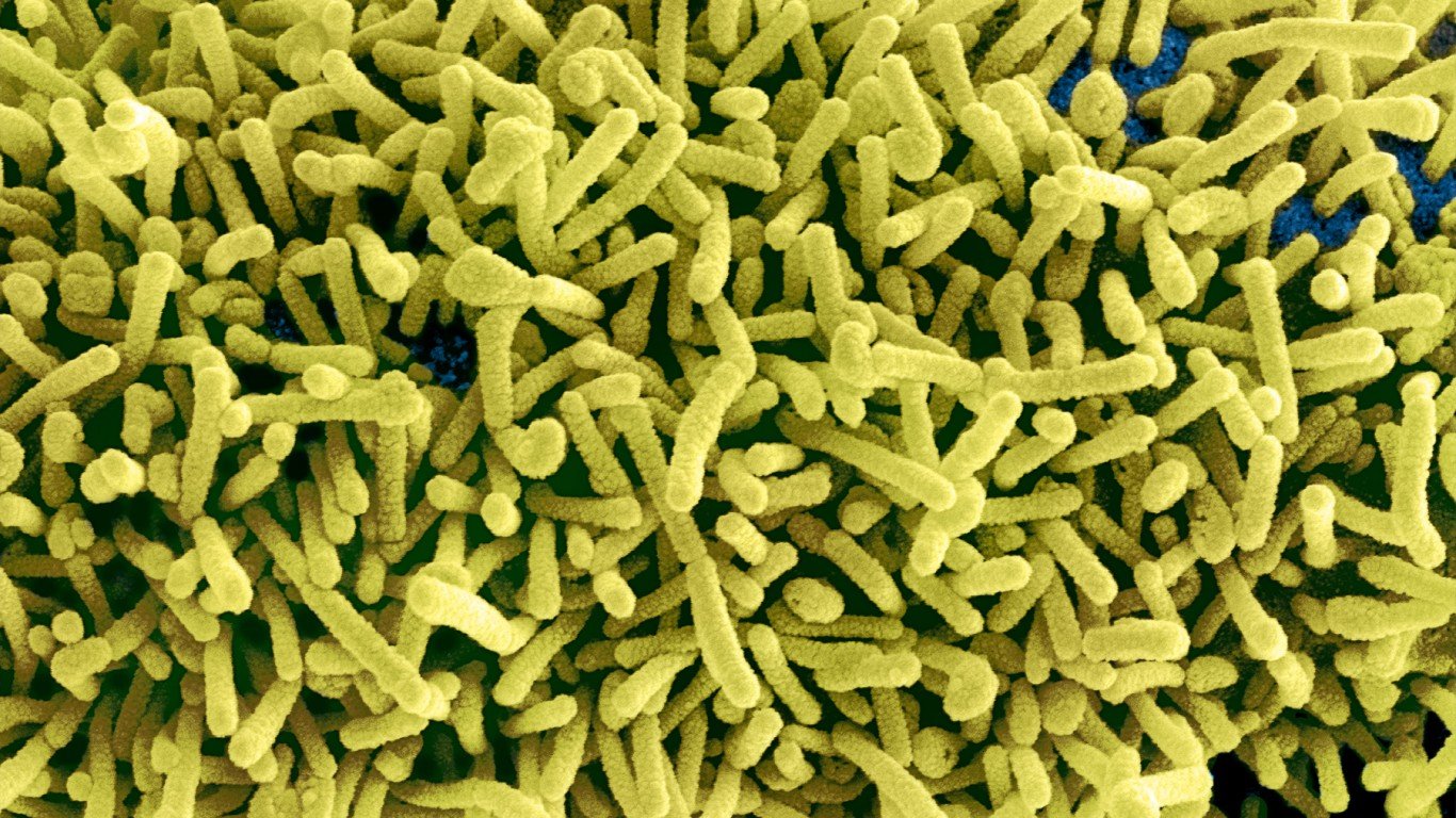 Marburg Virus Particles by NIAID