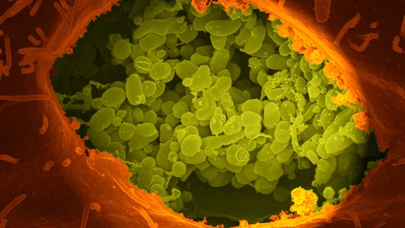 Coxiella burnetii, the Bacter... by NIAID